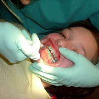 Duplicate Content Plaguing Orthodontist Websites